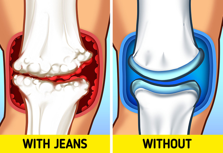 پوشیدن طولانی مدت شلوار جین تنگ چه عوارضی دارد؟