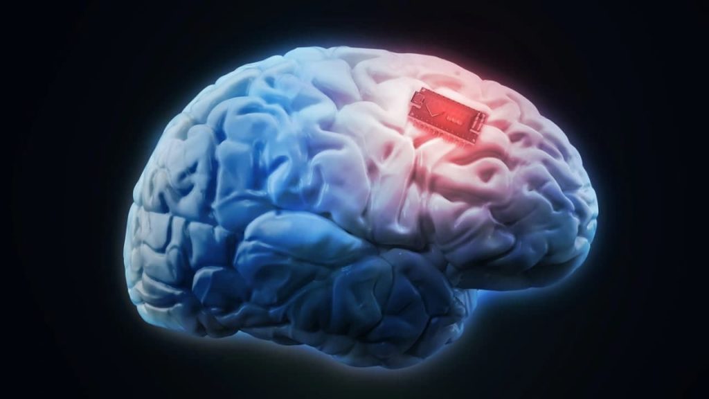 ایمپلنت مغزی به یک بیمار فلج قدرت ارتباط گرفتن با اطرافیانش را داد