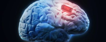 ایمپلنت مغزی به یک بیمار فلج قدرت ارتباط گرفتن با اطرافیانش را داد