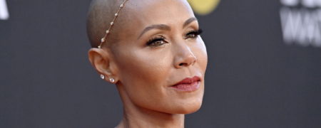 آلوپسی یا کچلی سکه ای؛ هرآنچه باید درباره بیماری همسر ویل اسمیت بدانید