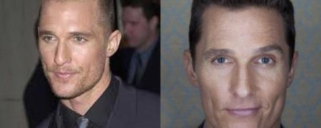 پزشکی که به دروغ ادعا داشت برای «متیو مک کانهی» مو کاشته، دستگیر شد