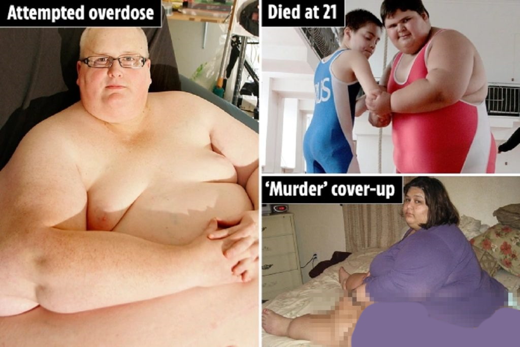 روایاتی از چاق‌ ترین افراد جهان و زندگی‌های غم‌انگیزشان