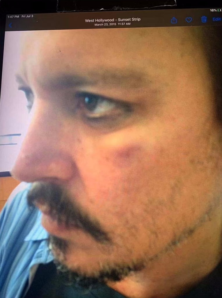 محافظ جانی دپ عکس هایی از صورت زخمی او در دادگاه منتشر کرد