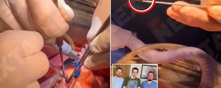 جراحی زنده؛ بیرون کشیدن گلوله از قلبِ در حال تپیدنِ سرباز مجروح اوکراینی + ویدیو