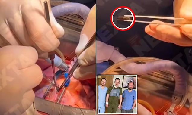 جراحی زنده؛ بیرون کشیدن گلوله از قلبِ در حال تپیدنِ سرباز مجروح اوکراینی + ویدیو