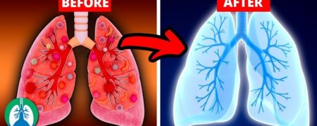 روش هایی طبیعی برای پاکسازی ریه ها از آلودگی هوا