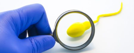 آزمایش اسپرم یا آنالیز مایع منی چیست؟ چرا و چگونه انجام می‌شود؟