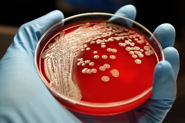 0 MRSA colonies on blood agar plate