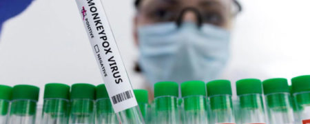 چگونه از خود در برابر آبله میمون محافظت کنیم و در صورت ابتلا به آن چه باید کرد؟