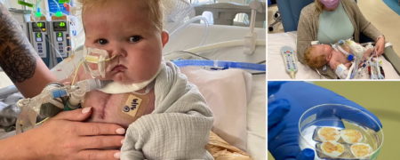 نوزاد آمریکایی با اولین پیوند قلب و تیموس در تاریخ پزشکی ماندگار شد