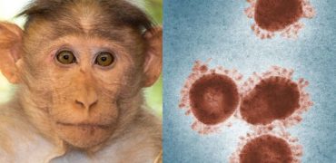 آبله میمونی یا ویروس میمون B چیست؟