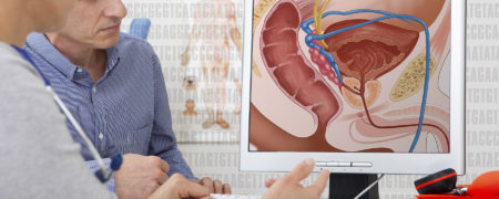 ۷ علامت هشدار دهنده سرطان پروستات در مردان؛ از جریان ضعیف ادرار تا زور زدن