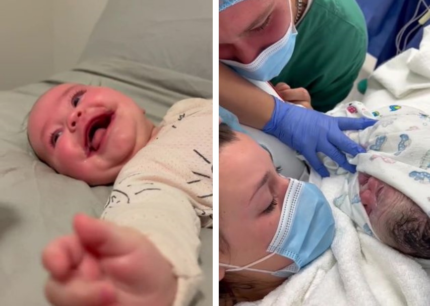 نوزادی که به خاطر یک بیماری نادر با لبخند دائمی متولد شد