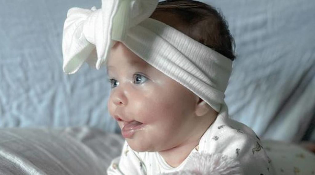 نوزادی که به خاطر یک بیماری نادر با لبخند دائمی متولد شد