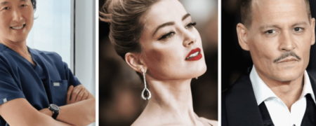 پاسخ پزشک تیک تاکی به احتمال انجام جراحی زیبایی توسط جانی دپ و امبر هرد + ویدیو