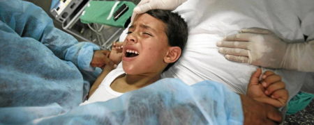 ختنه کردن در مردان چه مزایا و معایبی دارد؟