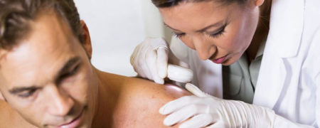 علائم اولیه سرطان پوست؛ تغییر خال یا لک می تواند اولین علامت هشدار دهنده باشند