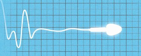 عوامل ناباروری : چه بیماری‌ها و عوارض جسمی مانع بچه دار شدن مردان و زنان می‌شود؟