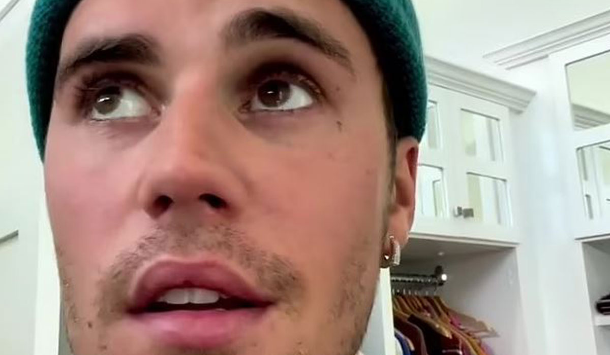 جاستین بیبر دچار فلج صورت سندرم رمزی هانت شده است! + ویدیو