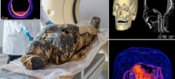 «زن اسرار آمیز»؛ اولین مومیایی ۲,۰۰۰ ساله باردار مصر باستان به سرطان مبتلا بوده است
