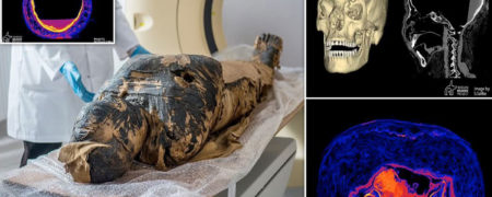 «زن اسرار آمیز»؛ اولین مومیایی ۲,۰۰۰ ساله باردار مصر باستان به سرطان مبتلا بوده است