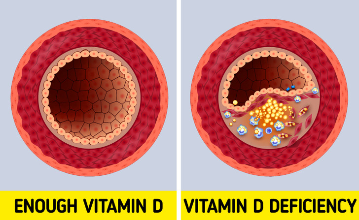 علائم هشدار دهنده کمبود ویتامین D چیست؟