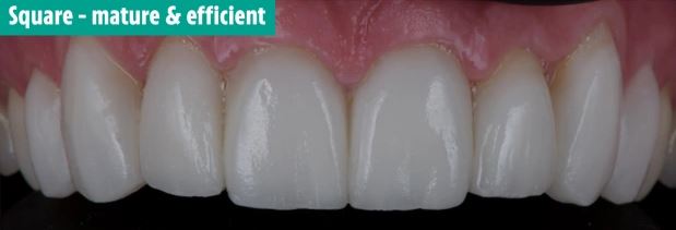 چگونه می توان از دندان ها ویژگی شخصیتی افراد را تشخیص داد؟