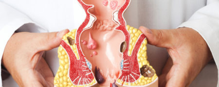 علائم سرطان مقعد چیست؟ آیا خارش باسن نشانه اولیه تومور است؟