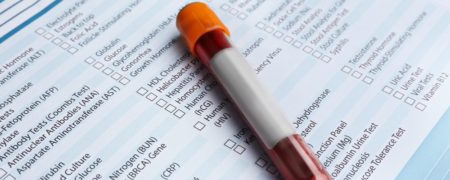 راهنمای خواندن جواب آزمایش خون ؛ چطور نتیجه آزمایش خون را تفسیر کنیم؟