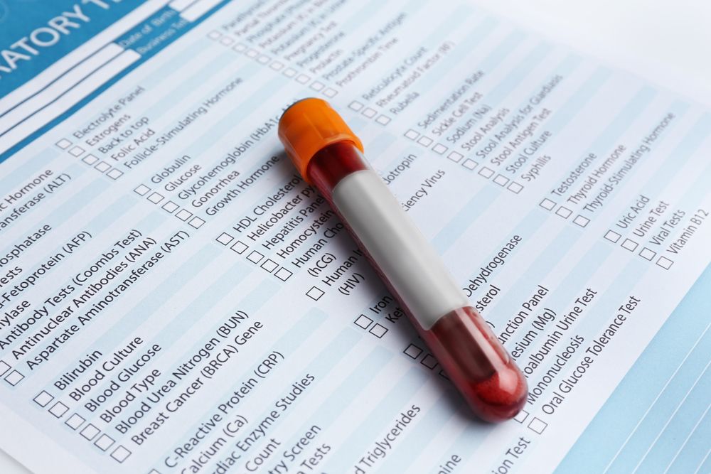 راهنمای خواندن جواب آزمایش خون ؛ چطور نتیجه آزمایش خون را تفسیر کنیم؟