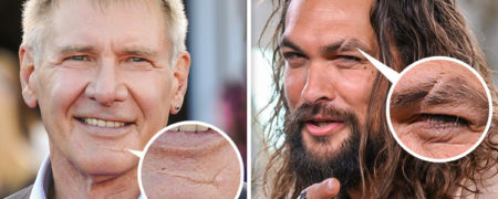 چرا مردانی که روی صورتشان زخم دارند در نگاه زنان جذاب تر هستند؟