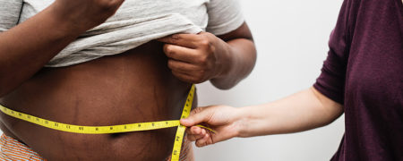 درمان عوارض ناشی از چاقی با اسلیو معده