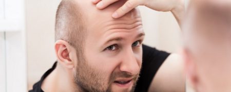 کشف جدید دانشمندان: درمان بالقوه برای طاسی فقط با یک ماده شیمیایی