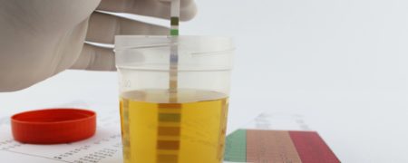 علت دفع پروتئین در ادرار چیست؟