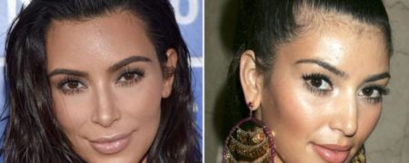 جراح زیبایی مشهور: «کیم کارداشیان ۱۶۰,۰۰۰ دلار برای جراحی پلاستیک هزینه کرده است»