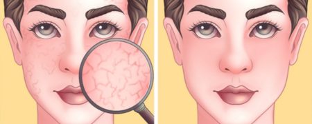 ۸ ترفند رایج در مراقبت از پوست که در واقع مضر هستند