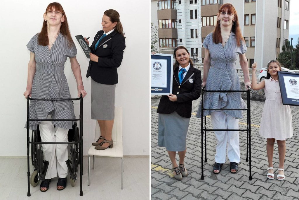 بلند قدترین زن جهان با بیش از ۲ متر قد: «متفاوت بودن را دوست دارم»