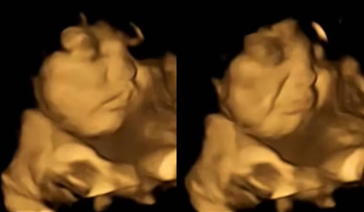 شگفت‌انگیزترین تصاویر از نوزاد در شکم مادر