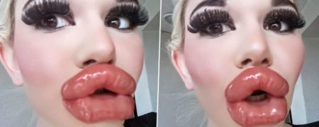 باربی بلغار و رکوردار بزرگ‌ترین لب‌های دنیا هنوز هم می‌خواهد به تزریق فیلر ادامه دهد