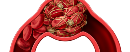 علائم لخته خون که هرگز نباید نادیده بگیرید: از تغییرات در نفس کشیدن تا رنگ پوست