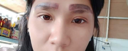 زن تایلندی با یک عملیات ناموفق تتوی ابرو صاحب چهار ابروی بزرگ شد