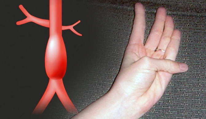 تست ساده انگشت شست که نشان می‌دهد در معرض خطر مرگ هستید