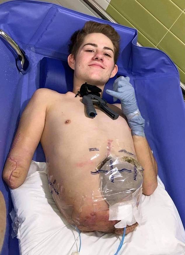 ماجرای نوجوانی که نصف بدنش زیر لیفتراک له شد