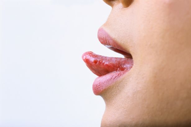 نشانه های بیماری های دهان و زبان چیست؟ 