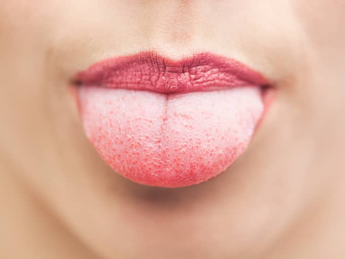 نشانه های بیماری های دهان و زبان چیست؟ 