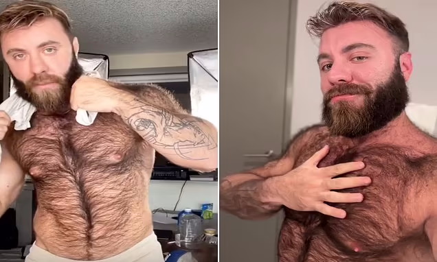 گرگینه واقعی؛ مردی که موهای بدنش سه ساعت بعد از اصلاح دوباره رشد می‌کند