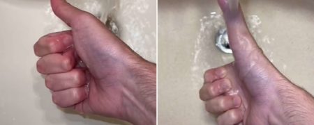 جوانی که می تواند اندازه انگشت شست خود را تغییر دهد در تیک تاک معروف شد + ویدیو