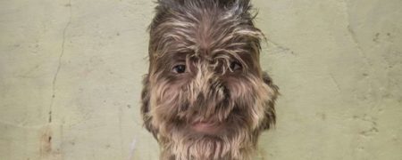 پسر مبتلا به سندرم گرگینه: «بچه ها می ترسیدند آنها را مثل یک حیوان گاز بگیرم»