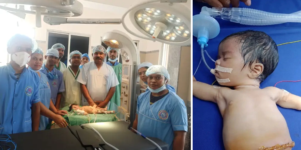 پزشکان در موردی بسیار نادر ۸ جنین را از معده یک نوزاد ۲۱ روزه خارج کردند + ویدیو