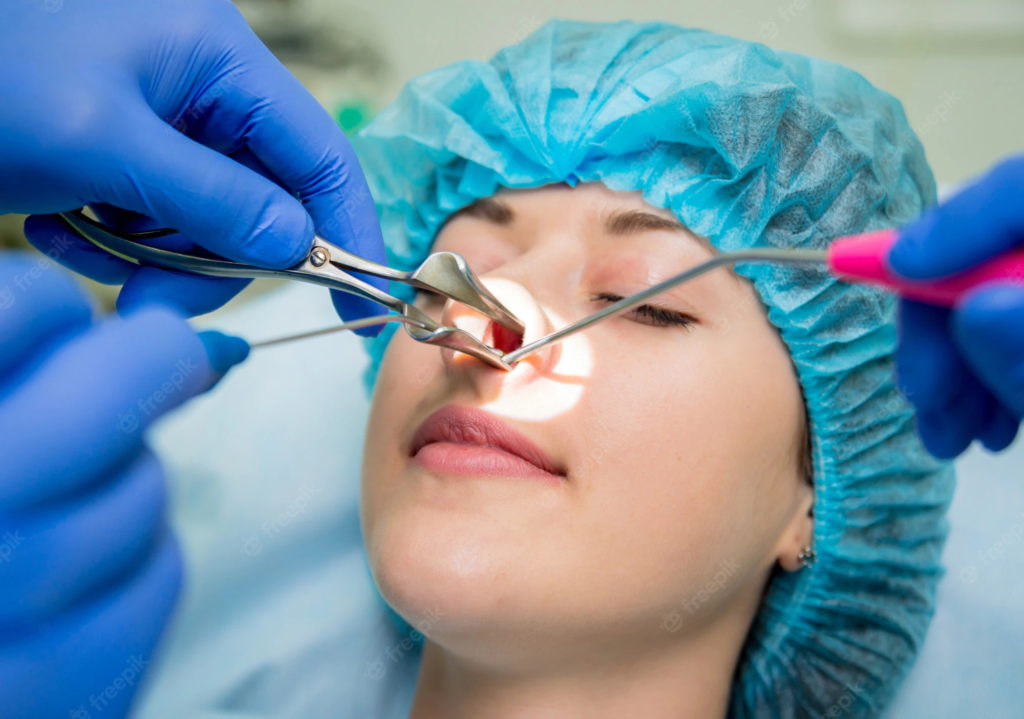 جراحی بینی چه انواعی دارد و مزایا و عوارض آن چیست؟